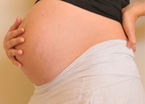 انتفاخ البطن أثناء الحمل تتنافس حول الصحة على Ilive