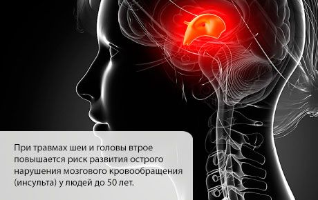 يزداد خطر الإصابة بالسكتة الدماغية في الأشهر الأولى بعد إصابة الرأس أو الرقبة